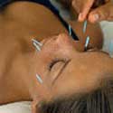 How The Needles Are Used By The Acupuncturist